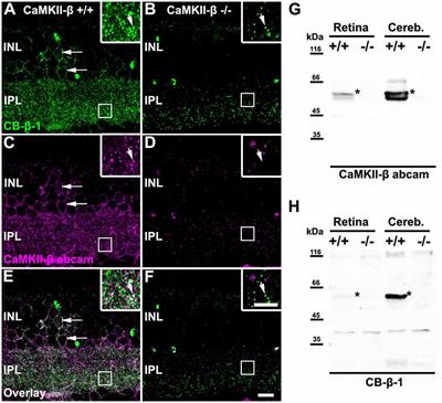 Localization of Retinal Ca2+/Calmodulin-Dependent Kinase II-β (CaMKII-β) at Bipolar Cell Gap Junctions and Cross-Reactivity of a Monoclonal Anti-CaMKII-β Antibody With Connexin36